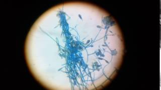 epidermophyton floccosum structure under 45x compound microscope [upl. by Rafiq227]