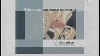 Tratamiento de la Artrosis de Cadera  3era parte  Dr Isaac Jakter  Calidad de Vida [upl. by Nanny]