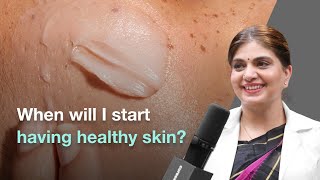 How Long Does It Take to See Healthy Skin  Cureskin [upl. by Tsuda249]