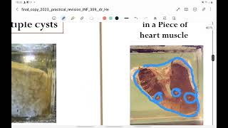 Practical parasitology Part 3 jars ptotozoa clinical pictures [upl. by Cormick]