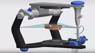 3Shape TRIOS Design Studio  Dynamic Virtual Articulator [upl. by Noelc]