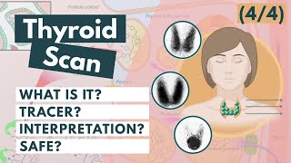 Thyroid Scan amp Radioactive Iodine  Nuclear medicine  Visual Explanation [upl. by Shoshana]