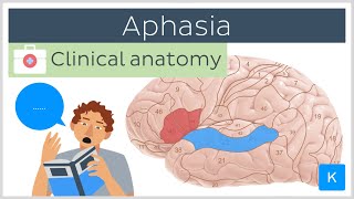 Aphasia Wernickes vs Brocas  Clinical Anatomy  Kenhub [upl. by Fredericka6]