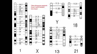 Cytogenetics II Chromosome Analysis amp Karyotypes [upl. by Rachele]