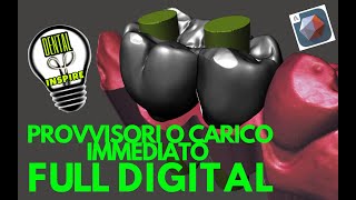 MESHMIXER DENTAL FULL DIGITAL PROVVISORIO A CARICO IMMEDIATO [upl. by Ahsircal]