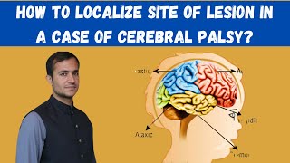 Cerebral palsy in Paediatrics localization of lesion site in different types of cerebral palsy [upl. by Geralda]