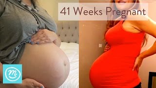 41 Weeks Pregnant What You Need To Know  Channel Mum [upl. by Joline]