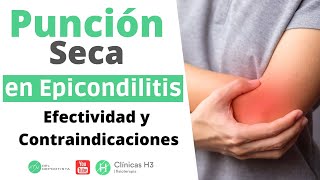 Punción seca para epicondilitis ¿Duele Contraindicaciones  Clínicas H3 [upl. by Ramedlab431]