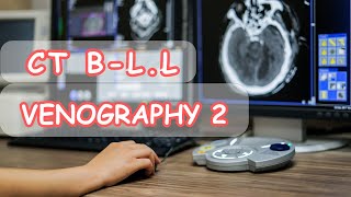 Ct venography reconstructionتقطيع واعادة بناء صور أوردة الطرفين السفليين [upl. by Heda965]