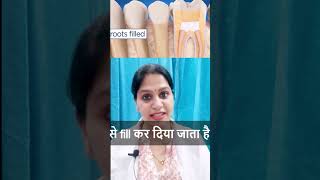 Pulpectomy  Pulpectomy in Children  Primary deciduous tooth treatment  दूधिया दांत उपचार [upl. by Gae]