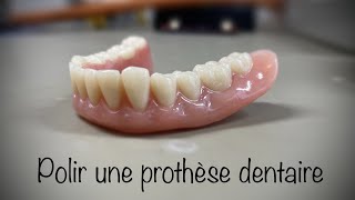 Prothèse amovible dentaire partielle le dentier avec crochets [upl. by Shoshana]