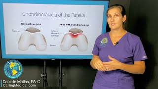 Can chondromalacia patella be treated with Prolotherapy FAQ about knee degeneration and arthritis [upl. by Ayota592]