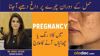 Melasma During Pregnancy  Hamal Men Chaiyon Ka Ilaj  How To Prevent Pregnancy Melasma  Dark Spots [upl. by Ykcim]