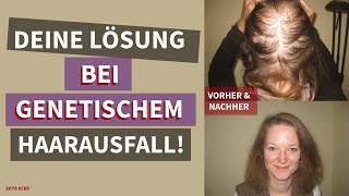 Erfolgreiche Behandlung von genetisch bedingtem Haarausfall mit Kaya Veda Produkten [upl. by Thad]