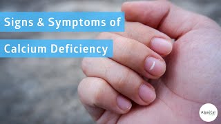 Signs amp Symptoms of Calcium Deficiency [upl. by Engen]