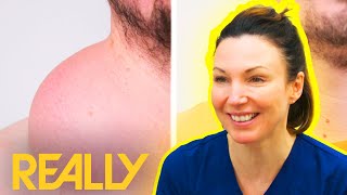 Dr Emma TRANSFORMS Man With Hernia Scars amp Woman With Rare Skin Condition  The Bad Skin Clinic [upl. by Anyahs]