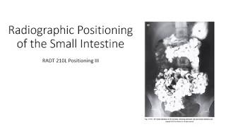 Radiographic Positioning of the Small Intestine [upl. by Baseler111]