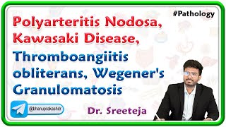 2 Polyarteritis Nodosa Kawasaki Disease Thromboangiitis obliterans Wegeners Granulomatosis [upl. by Ahsikyt]