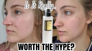 Cosrx Snail 96 Mucin Essence amp Snail All In One Cream  Review  1 Month Results On AcneProne Skin [upl. by Helfant]