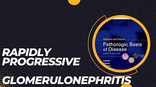 Rapidly progressive glomerulonephritis  RPGN  Pathogenesis  Morphology  Clinical features  Case [upl. by Enoj]