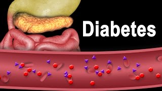 Diabetes Type 1 and Type 2 Animation [upl. by Regnij]