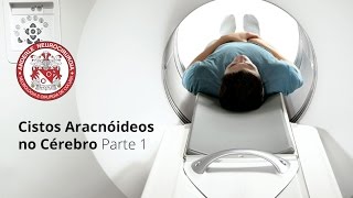 Cistos Aracnóideos no Cérebro  Parte 1  Dr Diogo Neurocirurgião [upl. by Toni101]