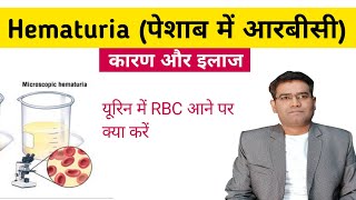 Hematuria RBC in Urine Causes Investigation and Treatment Explained in Hindi [upl. by Sunderland327]