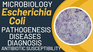 Escherichia coli pathogenesis  E coli microbiology  e coli general properties [upl. by Rehpotsrhc]