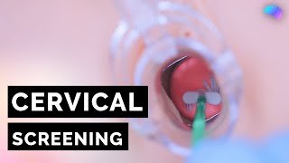 Cervical Screening Smear  HPV  OSCE Guide  UKMLA  CPSA [upl. by Naerda146]