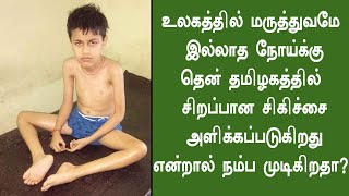 myopathy treatment  myopathy treatment in tamil nadu  Southern Herbals [upl. by Recha]