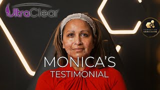 What is Ultraclear laser Monicas Testimonial  Yorkshire Skin Centre [upl. by Nwatna]