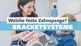 Feste Zahnspange  Bracketsysteme beim Kieferorthopäden  Welche Arten und Vorteile gibt es [upl. by Wager]