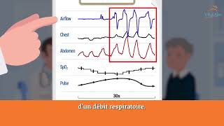 Polygraphie bien comprendre les résultats de mon examen du sommeil [upl. by Nnairet]