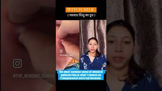 Witch milk or neonatal milk  नवजात 👼🏽शिशु का दूध  newborn paediatric maternal [upl. by Shay]