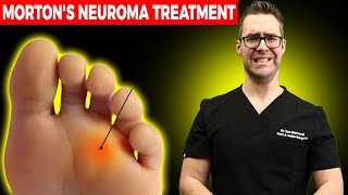 11 BEST Mortons Neuroma Massage Exercise amp Stretch Treatments WOW [upl. by Waddle]