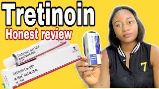 I used Tretinoin and here’s what happened [upl. by Slaughter]