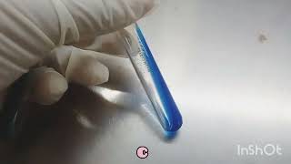 CITRATE test  Biochemicals in Microbiology  How to read [upl. by Vernier]