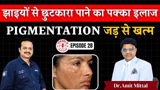 झाइयांदागधब्बे निशान सब गायब PRP Therapy से  Pigmentation जड़ से खत्म  In Hindi DrAmit Mittal [upl. by Troyes]