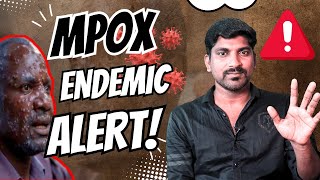 Mpox Outbreak Symptoms History and Latest Emergency Explained  Tamil  TP [upl. by Lorimer]