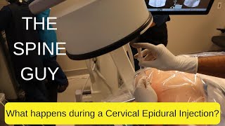 What happens during a Cervical Epidural [upl. by Niroc986]