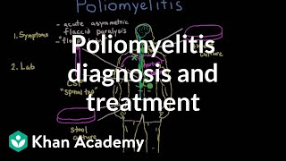 Poliomyelitis diagnosis and treatment  Infectious diseases  NCLEXRN  Khan Academy [upl. by Lizbeth465]