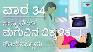 The Pregnancy  Kannada  Week by Week  Week 34 [upl. by Clayberg]