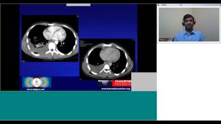 Radiology eteaching on Thoracic trauma [upl. by Morissa]