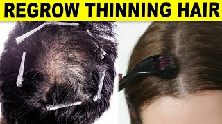 10 Ways To Regrow Your Hair Naturally [upl. by Nner]