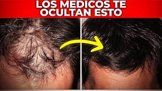 Remedios Naturales Para la Caída del Cabello que Realmente Funcionan [upl. by Laeira]