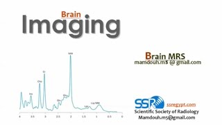 MR spectroscopy of brain DRE Prof Mamdouh Mahfouz [upl. by Llerod797]