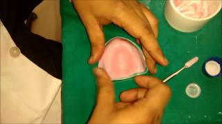 denture base preparation [upl. by Ashli783]