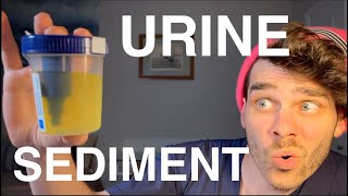 Urine Sediment Analysis  Learn How to Spin Urine  Interpret Cells amp Casts [upl. by Einneb575]