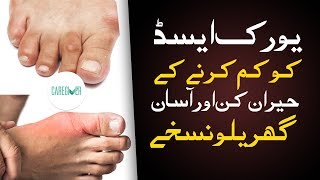 Uric Acid Treatment  Uric Acid ka ilaj uric acid home remedies  How to Reduce Uric Acid [upl. by Dodge]