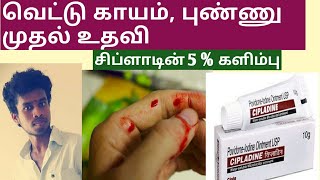 What is cipladine ointment uses side effects in tamil [upl. by Twitt]